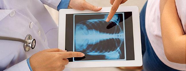 AI Takes Aim at Lung Cancer Screening - Yorkville Pharmacy